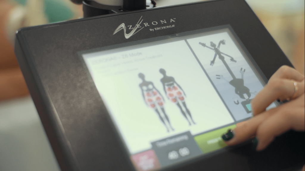 Zerona laser, erchonia, зерона